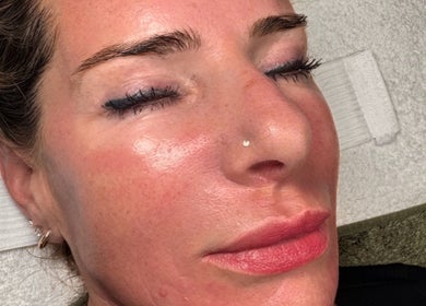 A woman enjoys a facial treatment at Khloe Sculpt Aesthetics in Caterham, England, GB, highlighting glowing skin.