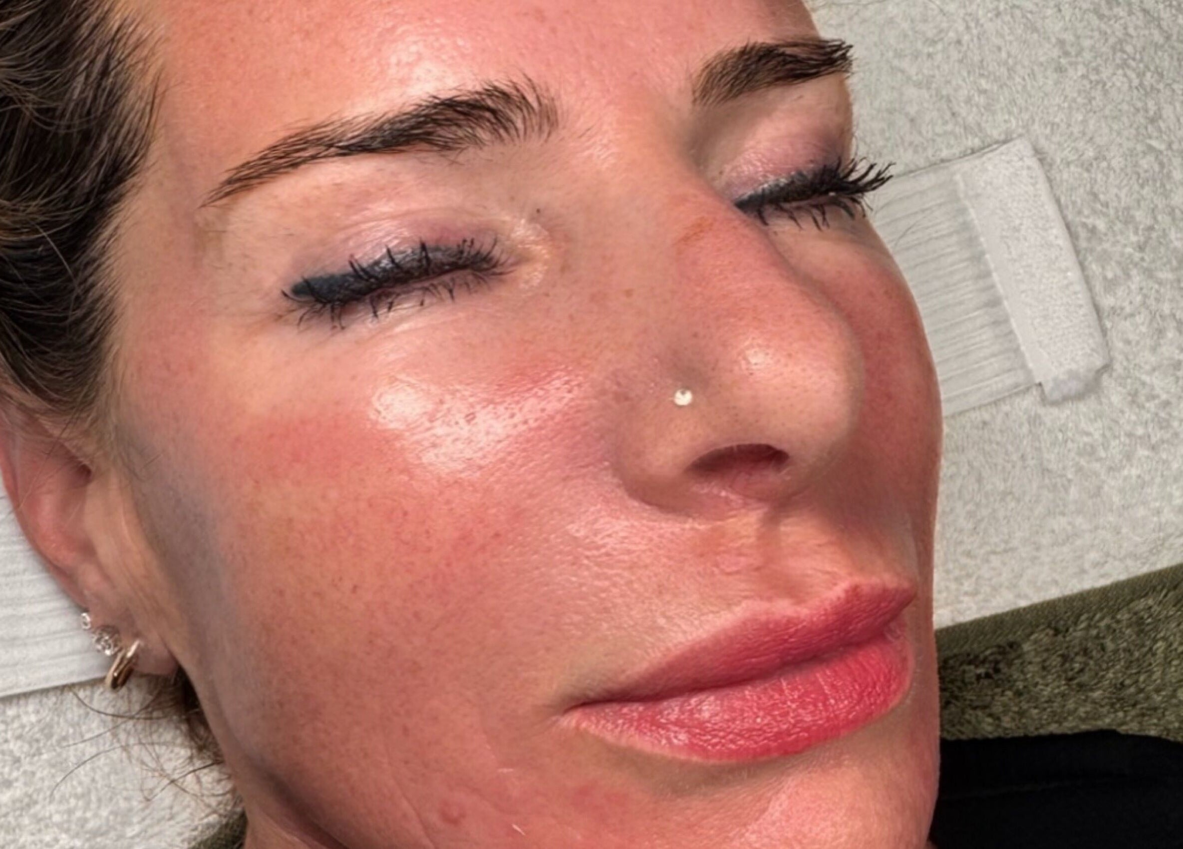 Client enjoying facial at Khloe Sculpt Aesthetics, Caterham, England, GB with radiant skin.