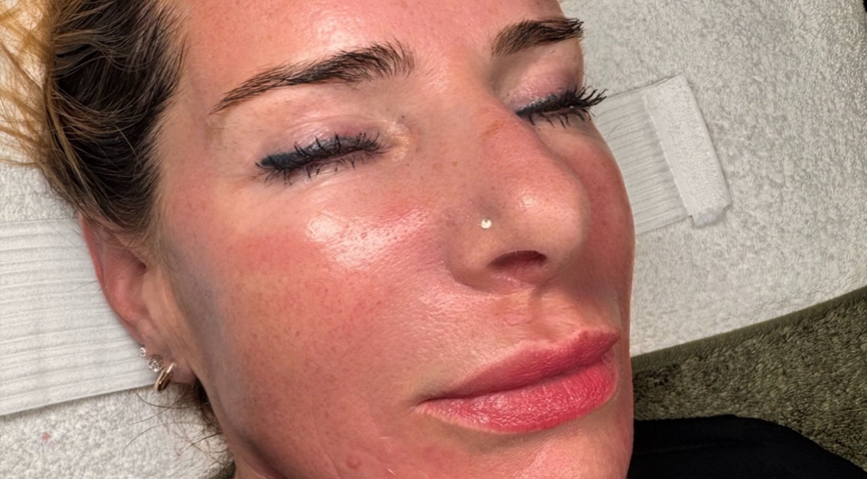 Client enjoying facial at Khloe Sculpt Aesthetics, Caterham, England, GB with radiant skin.
