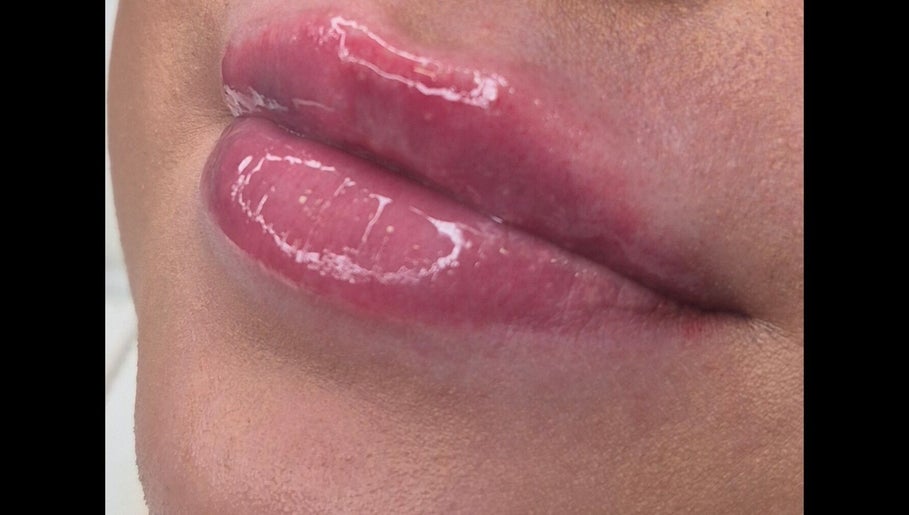 Close-up of glossy lips after beauty treatment at Ipswich, Ipswich, England, GB.