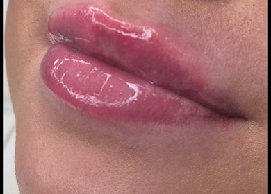 Close-up of glossy lips after beauty treatment at Ipswich, Ipswich, England, GB.
