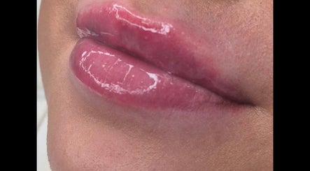 Close-up of glossy lips after beauty treatment at Ipswich, Ipswich, England, GB.
