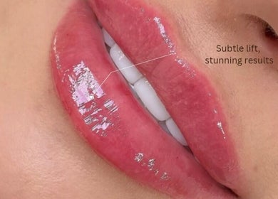 Close-up of glossy, well-defined lips showcasing beauty results from Ipswich, England, GB
