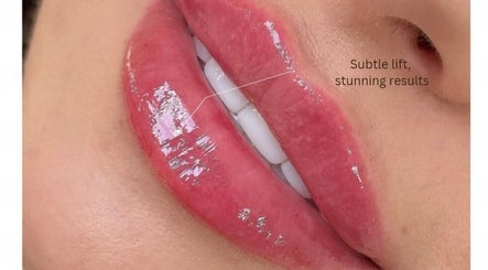 Close-up of glossy, well-defined lips showcasing beauty results from Ipswich, England, GB
