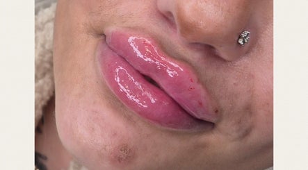 Close-up of glossy, enhanced lips at Ipswich beauty venue, Ipswich, England, GB.