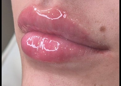 Glossy, voluminous lips at Ipswich venue for wellness in Ipswich, England, GB.