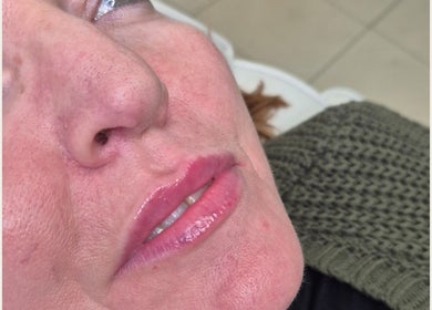 Close-up of a woman's rejuvenated lips at Ipswich, England, GB beauty venue.
