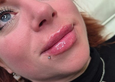 Close-up of glossy lips post-treatment at The Aesthetics Angel, London, England, GB.