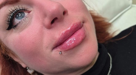 Close-up of glossy lips post-treatment at The Aesthetics Angel, London, England, GB.