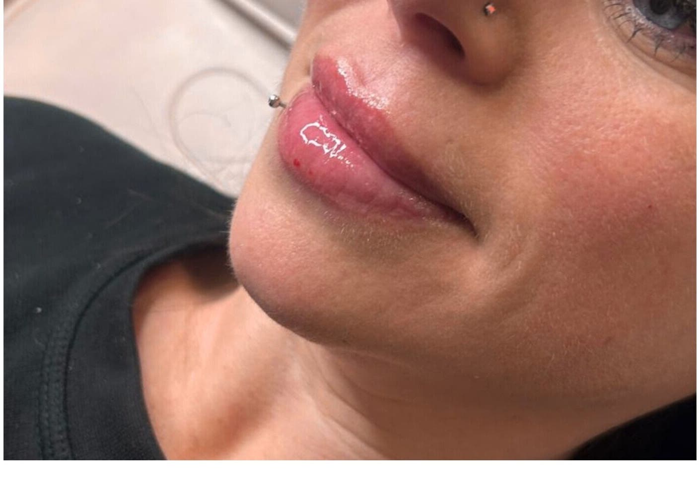 Close-up of enhanced lips at Aesthetics Angel, Ipswich, England, GB showcasing natural beauty.