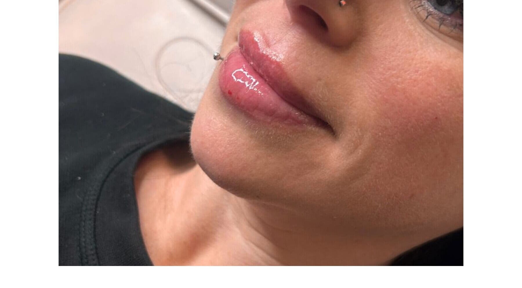 Close-up of enhanced lips at Aesthetics Angel, Ipswich, England, GB showcasing natural beauty.