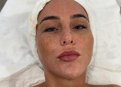Facial treatment at Enhanced ByEl, Leeds, England, GB showcasing skincare rejuvenation results.