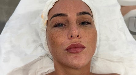 Facial treatment at Enhanced ByEl, Leeds, England, GB showcasing skincare rejuvenation results.