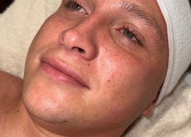 Relaxed face during facial treatment at Enhanced ByEl, Leeds, England, GB, showcasing smooth skin radiance.