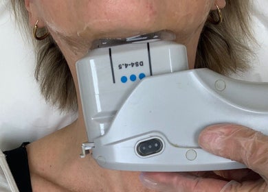 Skin rejuvenation procedure at Sky Spa Laser in Forest Hills, New York, US, highlighting advanced beauty techniques.