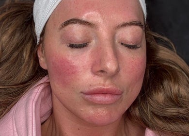 Client enjoying skincare session at Skin By Charlie, Sunderland, England, GB. Glowing skin with relaxation.