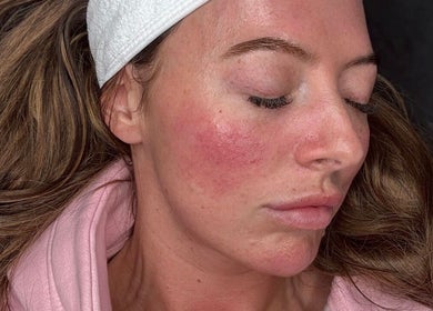 Close-up of a glowing woman’s face post-facial at Skin By Charlie, Sunderland, England, GB.