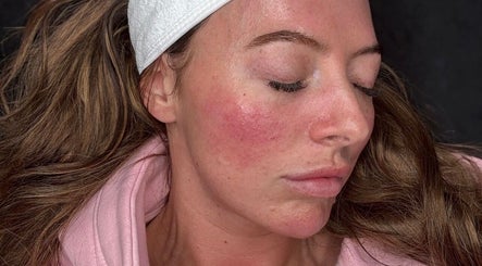 Close-up of a glowing woman’s face post-facial at Skin By Charlie, Sunderland, England, GB.