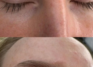 Before and after eyebrow transformation at Jo Beauty Experts, Melbourne, Victoria, AU.