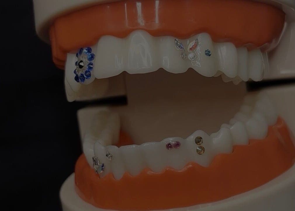 Decorative tooth gems showcased at Soulbi studio, Primbee, New South Wales, AU.