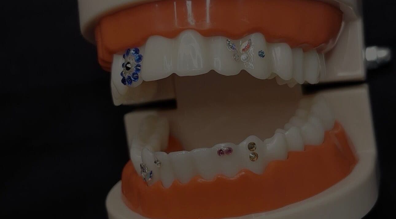 Decorative tooth gems showcased at Soulbi studio, Primbee, New South Wales, AU.