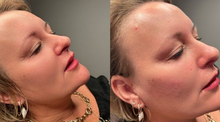 Client skincare results at Beauty Station, Brighton And Hove, England, GB. Smooth, radiant complexion.