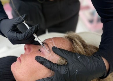 Botox treatment at Aura aesthetics by Abbie in Chilton, England, GB offering expert beauty care.