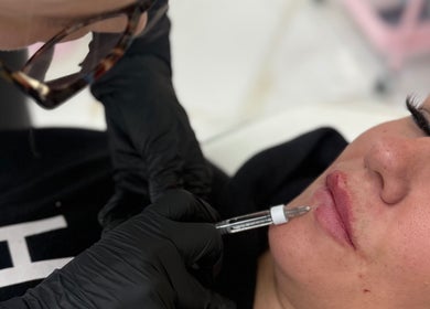 Expert performing lip injection at Aura aesthetics by Abbie, Chilton, England, GB.