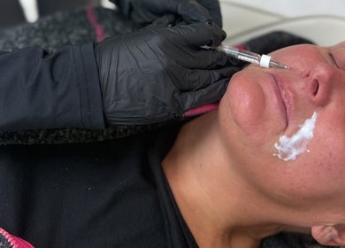 Facial treatment at Aura aesthetics by Abbie in Chilton, England, GB showcasing precision skincare.