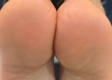 Close-up of smooth feet after treatment at NailsbyAjita, Northwood, England, GB.