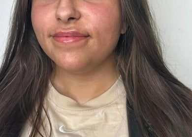 Close-up of a woman's glowing skin after treatment at Flawless Moments, North Shields, England, GB.