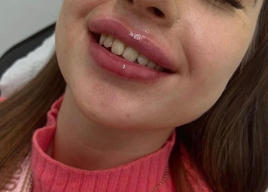 Happy client with enhanced lips at Flawless Moments, North Shields, England, GB.