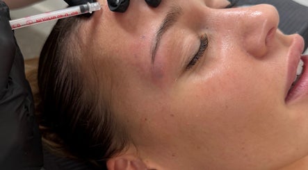 Facial treatment at Blacks clinic, Watford, England, GB, featuring a relaxed client receiving Botox.