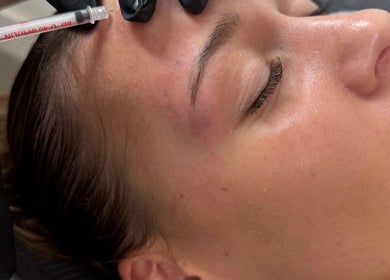 Blacks Clinic in Watford, England, GB offers expert Botox treatments for smoother skin.