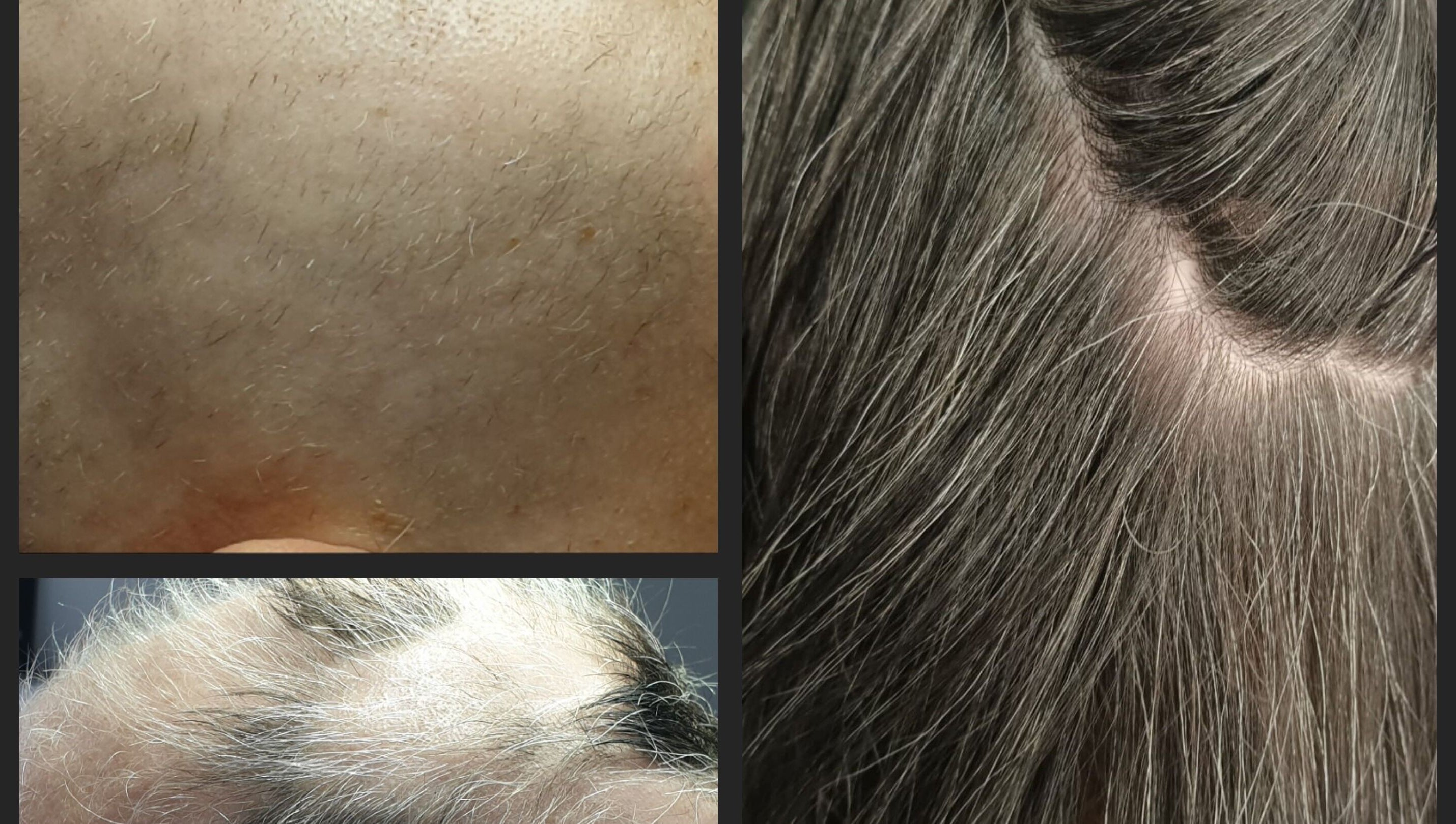 Close-ups of scalp and hair at The SLiM Solution, Jeffreys Bay, Eastern Cape, ZA.