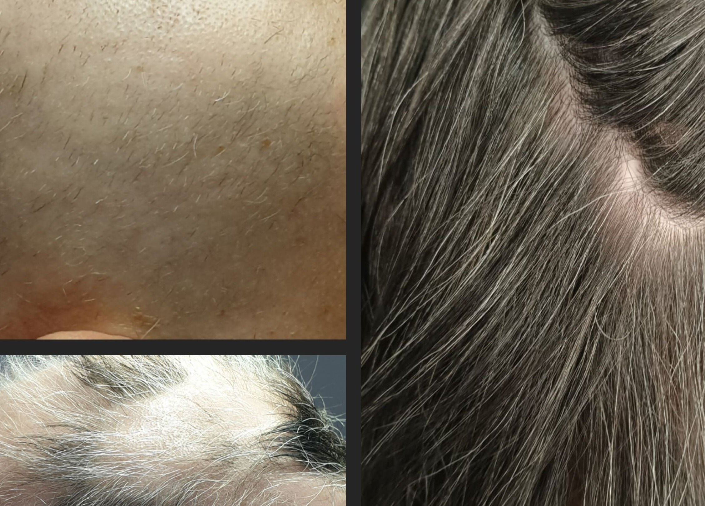 Close-ups of scalp and hair at The SLiM Solution, Jeffreys Bay, Eastern Cape, ZA.