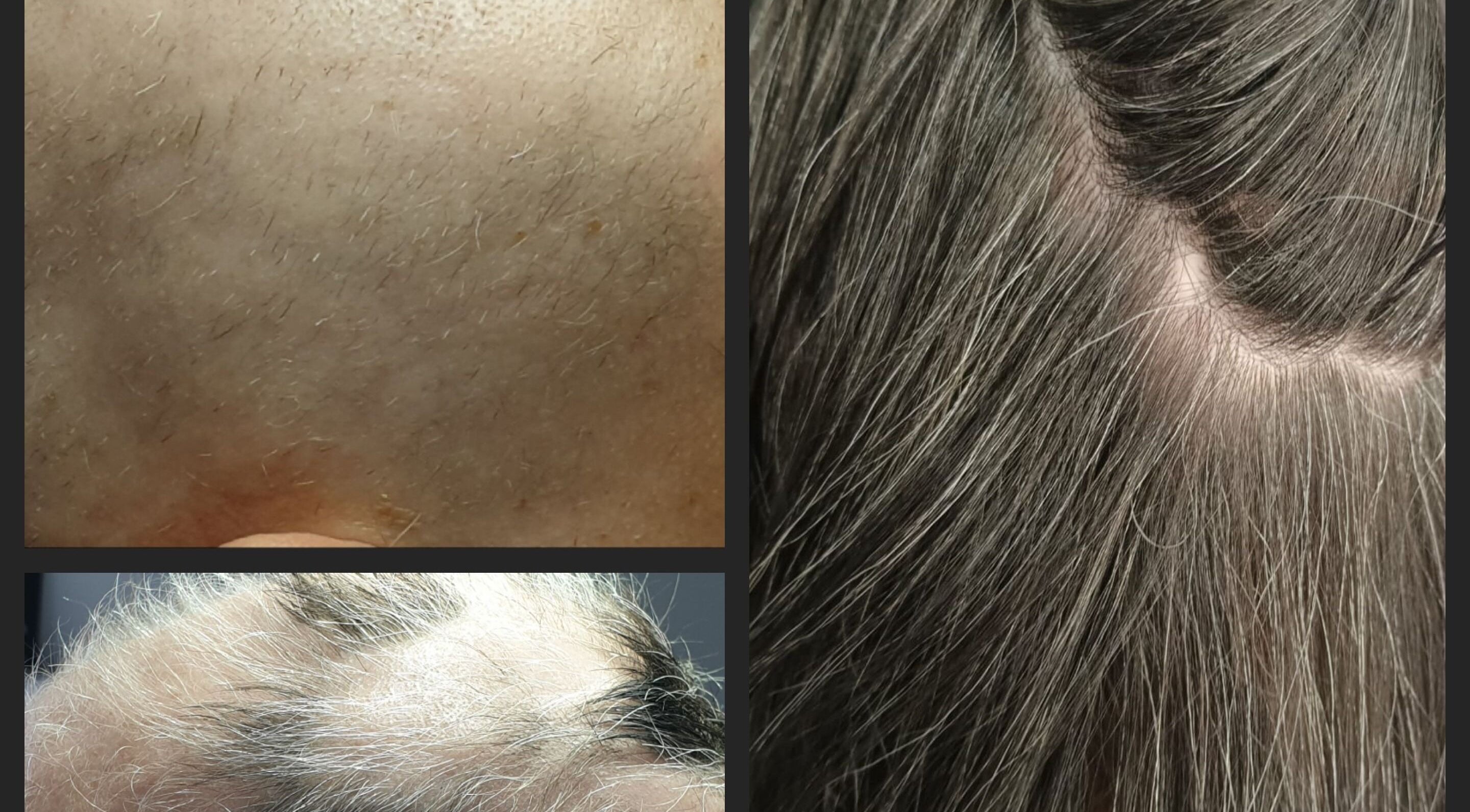 Close-ups of scalp and hair at The SLiM Solution, Jeffreys Bay, Eastern Cape, ZA.