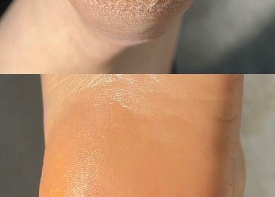 Before and after foot treatment at AFA Studio Nails & Beauty, Dublin, County Dublin, IE.