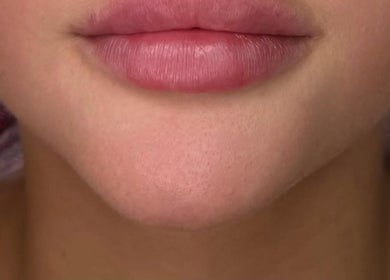 Close-up of well-nourished lips at Bareface Skin Clinic, Liverpool, England, GB showcasing natural beauty.