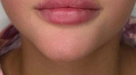 Close-up of well-nourished lips at Bareface Skin Clinic, Liverpool, England, GB showcasing natural beauty.