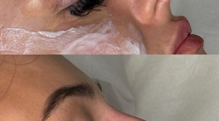 Facial treatment at Aestheticsandskinbyjazmin, Ashington, England, GB showcasing smooth, glowing skin results.