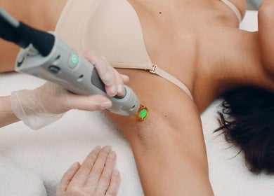 Traitement d'épilation laser chez New Life Skin, Gibloux, Fribourg, CH, pour une peau lisse et soignée.
