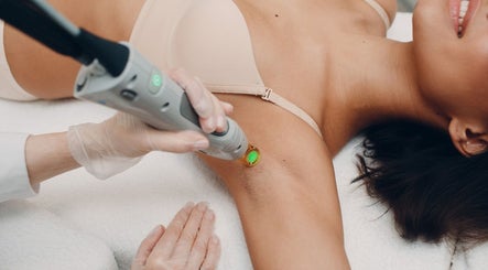 Traitement d'épilation laser chez New Life Skin, Gibloux, Fribourg, CH, pour une peau lisse et soignée.