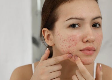 Femme soignant sa peau au centre New Life Skin à Gibloux, Fribourg, CH.