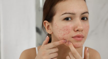 Femme traitant sa peau à New Life Skin, Gibloux, Fribourg, CH. Soins contre l'acné.