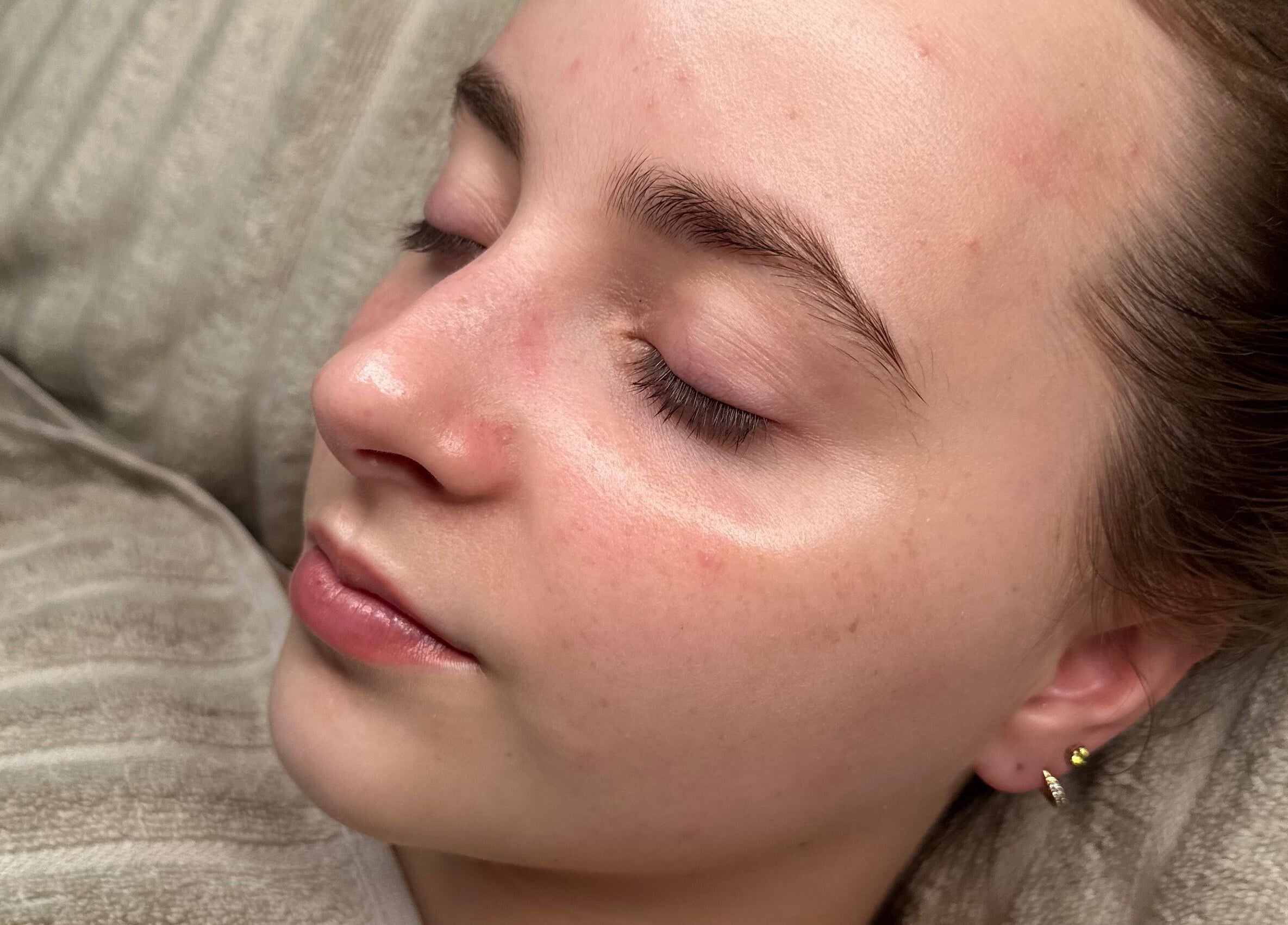 Relaxed face after a facial at Beauty by Claudie, Gamlingay, England, GB. Skin appears smooth and rejuvenated.