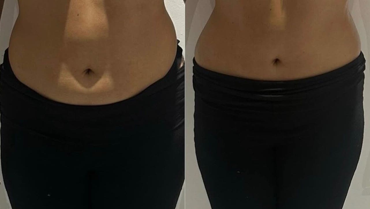Before and after waist transformation at Detox and Drain, Radcliffe, England, GB showcasing slimming results.