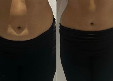 Before and after waist transformation at Detox and Drain, Radcliffe, England, GB showcasing slimming results.