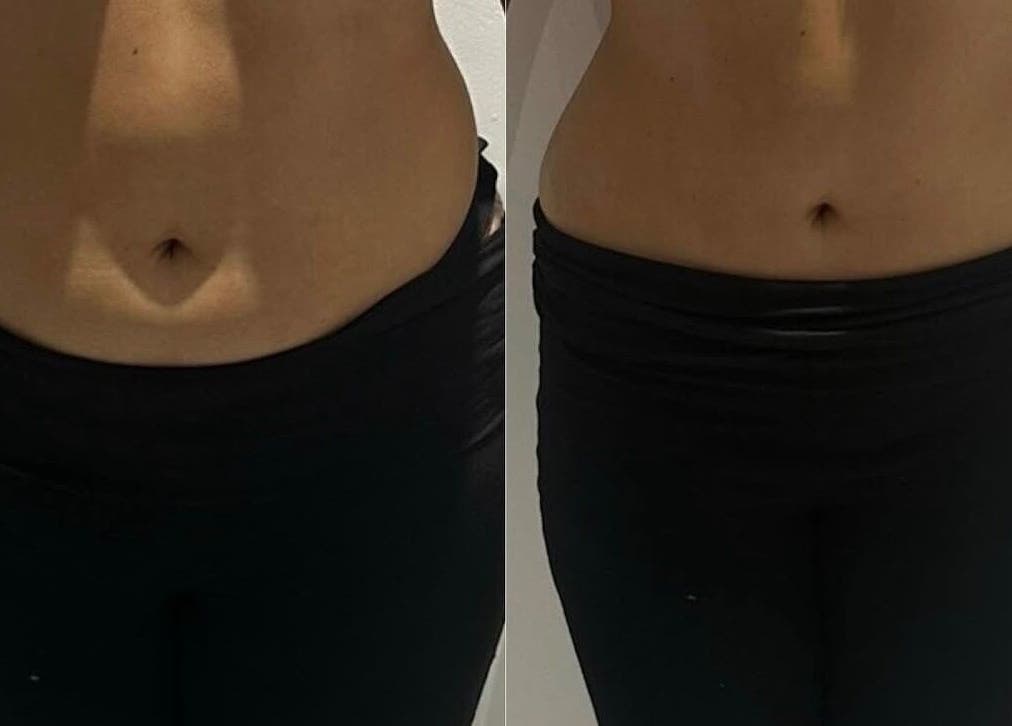 Before and after waist transformation at Detox and Drain, Radcliffe, England, GB showcasing slimming results.