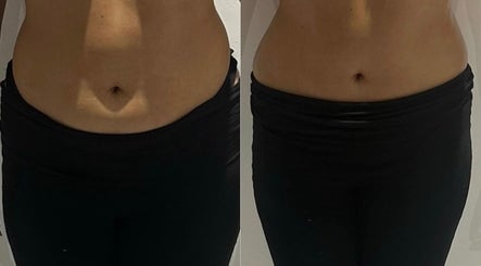 Before and after waist transformation at Detox and Drain, Radcliffe, England, GB showcasing slimming results.